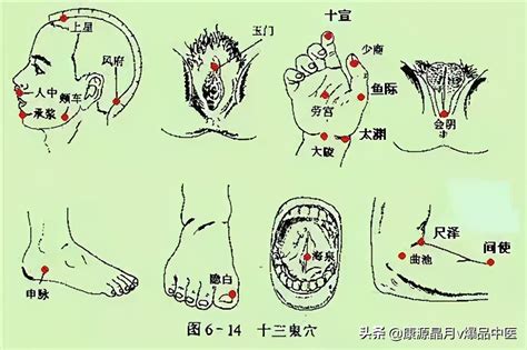 鬼穴|《中醫詞典》解釋「十三鬼穴」的意思